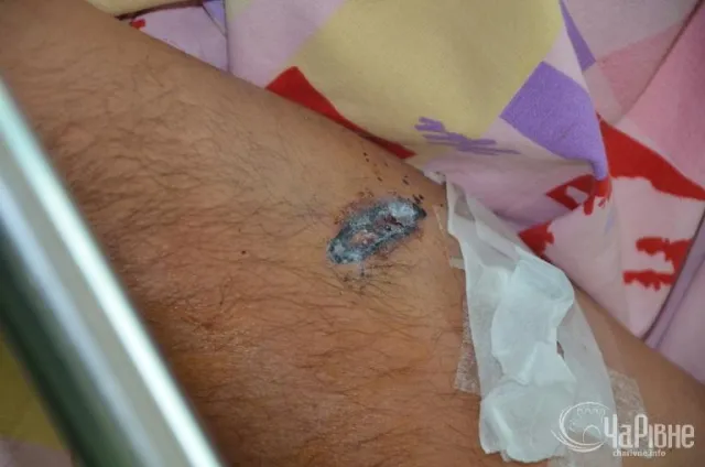Поранений Бузинарським просить Порошенка, аби той захистив його від мажора у погонах (Фото) — фото 3