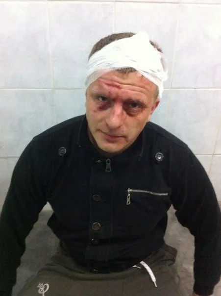Рівненський активіст Євгеній Пупишев отримав три ножові поранення та кілька ударів по голові (Фото) — фото 1